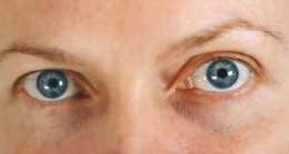體內有癌，眼睛先知？提醒：眼睛出現這種顏色，儘早去排查肝癌