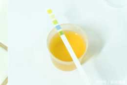 排尿時出現尿液顏色發黃的現象，或與這5個因素有關，需重視