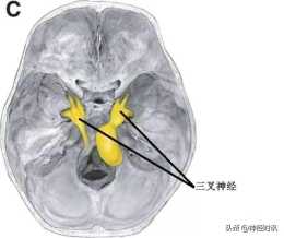 體表神經解剖：三叉神經詳解
