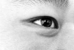 呵護眼健康 預防過敏性結膜炎