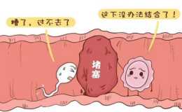 什麼是“輸卵管造影”